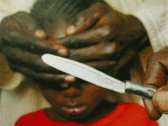 ختنه دختران، ممنوع!