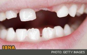 از دندان‌های شیری محافظت کنید