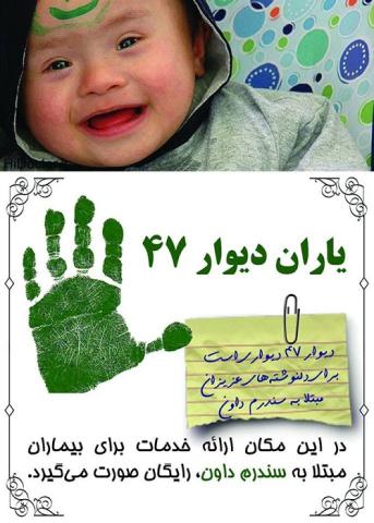 دعوت از پزشکان برای معاینه رایگان کودکان سندرم داون